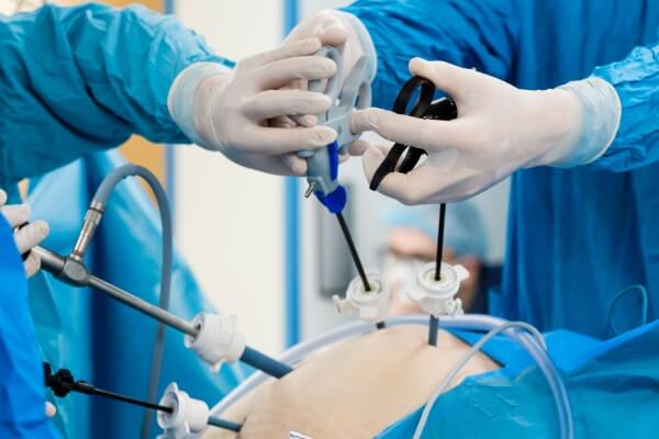 Laparoscopic Surgery