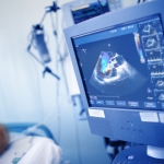 2D Echo (Echocardiography)